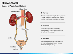 Renal Failure PPT Slide 5