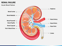 Renal Failure PPT Slide 2