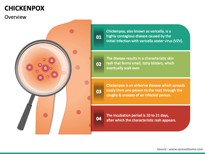 Chickenpox PowerPoint Slide 1
