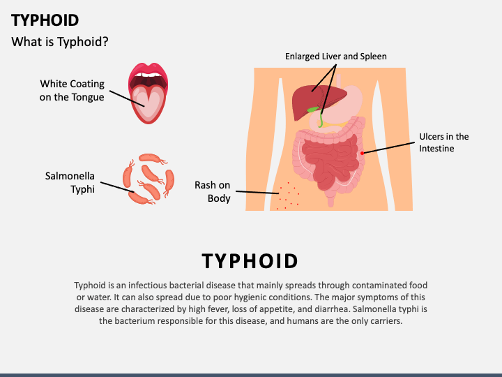 Typhoid PPT Slide 1